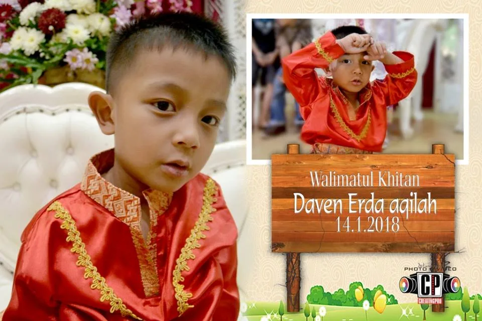 Khitanan pada Usia Dewasa dan Hal yang Berbeda